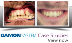 damon case studies